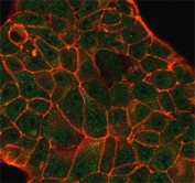 Immunofluorescent staining of PFA-fixed human MCF-7 using Decapping Protein 2 antibody (green, clone PCRP-DCP2-1D6) and phalloidin (red).