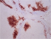 IHC staining of FFPE human liver tissue with GLUL antibody (clone GLUL/6599) at 2ug/ml. HIER: boil tissue sections in pH 9 10mM Tris with 1mM EDTA for 20 min and allow to cool before testing.