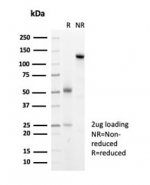 SDS-PAGE analysis of purified, BSA-free recombinant  HSP27 antibody (clone HSPB1/7038R) as confirmation of integrity and purity.
