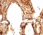 IHC staining of FFPE human prostate tissue with recombinant HSP27 antibody (clone HSPB1/7038R). HIER: boil tissue sections in pH 9 10mM Tris with 1mM EDTA for 20 min and allow to cool before testing.