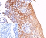 IHC staining of FFPE human tonsil tissue with STING1 antibody (clone STING1/7431). Negative control inset: PBS instead of primary antibody to control for secondary binding. HIER: boil tissue sections in pH 9 10mM Tris with 1mM EDTA for 20 min and allow to cool before testing.