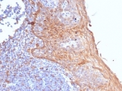 IHC staining of FFPE human tonsil tissue with STING1 antibody (clone STING1/7431). HIER: boil tissue sections in pH 9 10mM Tris with 1mM EDTA for 20 min and allow to cool before testing.