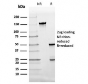SDS-PAGE analysis of purified, BSA-free FABP4 antibody (clone FABP4/4424) as confirmation of integrity and purity.