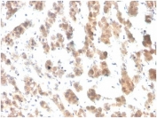 IHC staining of FFPE human adrenal gland tissue with IL-7 antibody (clone IL7/4012). HIER: boil tissue sections in pH 9 10mM Tris with 1mM EDTA for 20 min and allow to cool before testing.