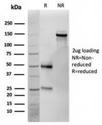 SDS-PAGE analysis of purified, BSA-free IL-25 antibody (clone IL25/625) as confirmation of integrity and purity.