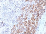 IHC staining of FFPE human adrenal gland tissue with IL-25 antibody (clone IL25/625). HIER: boil tissue sections in pH 9 10mM Tris with 1mM EDTA for 20 min and allow to cool before testing.