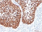 IHC staining of FFPE human cervical tissue with SOX2 antibody (clone SOX2/4267R) at 2ug/ml in PBS for 30min RT. HIER: boil tissue sections in pH 9 10mM Tris with 1mM EDTA for 20 min and allow to cool before testing.