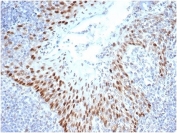 IHC staining of FFPE human tonsil tissue with SOX2 antibody (clone SOX2/4267R) at 2ug/ml in PBS for 30min RT. Strong nuclear staining observed. HIER: boil tissue sections in pH 9 10mM Tris with 1mM EDTA for 20 min and allow to cool before testing.
