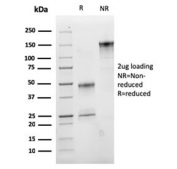 SDS-PAGE analysis of purified, BSA-free VLDLR antibody (clone rVLDLR/1337) as confirmation of integrity and purity.