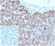 IHC staining of FFPE human pancreatic tissue with VLDLR antibody (clone rVLDLR/1337). Negative control inset: PBS instead of primary antibody to control for secondary binding. HIER: boil tissue sections in pH 9 10mM Tris with 1mM EDTA for 20 min and allow to cool before testing.