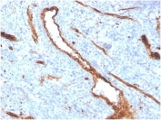 IHC staining of FFPE human bone marrow with recombinant von Willebrand Factor antibody (clone VWF/4384R). HIER: boil tissue sections in pH 9 10mM Tris with 1mM EDTA for 20 min and allow to cool before testing.
