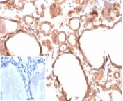 IHC staining of FFPE human thyroid tissue with Calcitonin antibody (clone CALCA/3310). Negative control insert: PBS used in place of primary antibody. HIER: boil tissue sections in pH 9 10mM Tris with 1mM EDTA for 20 min and allow to cool before testing.
