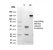 SDS-PAGE analysis of purified, BSA-free Fibroblast Growth Factor 23 antibody (clone FGF23/4174) as confirmation of integrity and purity.
