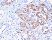 IHC staining of FFPE human kidney tissue with Fibroblast Growth Factor 23 antibody (clone FGF23/4174) at 2ug/ml in PBS for 30min RT. Negative control inset: PBS instead of primary antibody to control for secondary binding. HIER: boil tissue sections in pH 9 10mM Tris with 1mM EDTA for 20 min and allow to cool before testing.