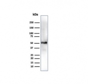 Western blot testing of human HEPG-2 cell lysate using Aldehyde Dehydrogenase 1A1 antibody (clone ALDH1A1/4793). Expected molecular weight ~55 kDa.