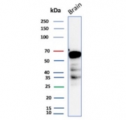 Western blot testing of human brain tissue lysate using Aldehyde Dehydrogenase 1A1 antibody (clone ALDH1A1/4793). Expected molecular weight ~55 kDa.