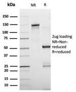 SDS-PAGE analysis of purified, BSA-free Fatty Acid Binding Protein 4 antibody (clone FABP4/4429) as confirmation of integrity and purity.