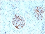 IHC staining of FFPE human kidney tissue with Fatty Acid Binding Protein 4 antibody (clone FABP4/4429) at 2ug/ml in PBS for 30min RT. HIER: boil tissue sections in pH 9 10mM Tris with 1mM EDTA for 20 min and allow to cool before testing.
