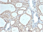 IHC staining of FFPE human thyroid tissue with ZHX3 antibody (clone PCRP-ZHX3-1G3)at 2ug/ml. HIER: boil tissue sections in pH 9 10mM Tris with 1mM EDTA for 20 min and allow to cool before testing.