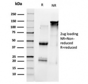 SDS-PAGE analysis of purified, BSA-free TFIIB antibody (clone PCRP-GTF2B-1D1) as confirmation of integrity and purity.