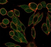 Immunofluorescent staining of PFA-fixed human HeLa cells using HDAC1 antibody (green, clone PCRP-HDAC1-1B7) and phalloidin (red).