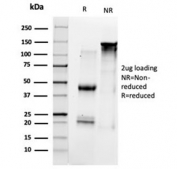 SDS-PAGE analysis of purified, BSA-free HDAC1 antibody (clone PCRP-HDAC1-1B7) as confirmation of integrity and purity.