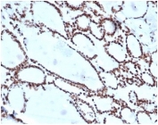 IHC staining of FFPE human thyroid tissue with HOXB2 antibody (clone PCRP-HOXB2-1F2) at 2ug/ml in PBS for 30min RT. HIER: boil tissue sections in pH 9 10mM Tris with 1mM EDTA for 20 min and allow to cool before testing.
