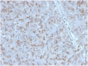 IHC staining of FFPE human adrenal gland tissue with Interleukin 15 antibody (clone IL15/4353). HIER: boil tissue sections in pH 9 10mM Tris with 1mM EDTA for 20 min and allow to cool before testing.