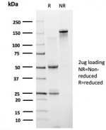 SDS-PAGE analysis of purified, BSA-free ZNF81 antibody (clone PCRP-ZNF81-2G2) as confirmation of integrity and purity.