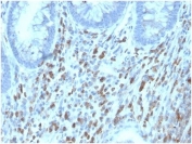 IHC staining of FFPE human adrenal gland tissue with Interleukin 6 Receptor subunit beta antibody (clone IL6ST/4101). HIER: boil tissue sections in pH 9 10mM Tris with 1mM EDTA for 20 min and allow to cool before testing.