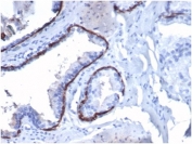 IHC staining of FFPE human prostate tissue with CK14 antibody (clone KRT14/4130) at 2ug/ml. HIER: boil tissue sections in pH 9 10mM Tris with 1mM EDTA for 20 min and allow to cool before testing.