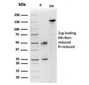 SDS-PAGE analysis of purified, BSA-free Lysozyme C antibody (clone LYZ/3943) as confirmation of integrity and purity.