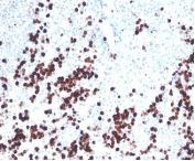 IHC staining of FFPE human spleen tissue with Lysozyme C antibody (clone LYZ/3943). HIER: boil tissue sections in pH 9 10mM Tris with 1mM EDTA for 20 min and allow to cool before testing.