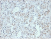 IHC staining of FFPE human adrenal gland tissue with recombinant IL15 antibody (clone IL15/7048R). HIER: boil tissue sections in pH 9 10mM Tris with 1mM EDTA for 20 min and allow to cool before testing.