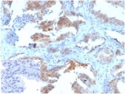 IHC staining of FFPE human prostate tissue with MIF antibody (clone MIF/3489). Negative control inset: PBS instead of primary antibody to control for secondary binding. HIER: boil tissue sections in pH 9 10mM Tris with 1mM EDTA for 20 min and allow to cool before testing.