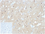 IHC staining of FFPE human brain tissue with Aquaporin 4 antibody (clone AQP4/3324). Negative control inset: PBS instead of primary antibody to control for secondary binding.