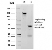 SDS-PAGE analysis of purified, BSA-free Aquaporin 4 antibody (clone AQP4/3324) as confirmation of integrity and purity.