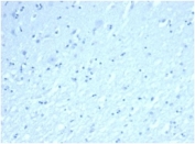 SDS-PAGE analysis of purified, BSA-free recombinant INHA antibody (clone rINHA/6919) as confirmation of integrity and purity.