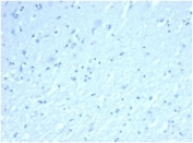 Negative control: IHC staining of FFPE human brain tissue using recombinant INHA antibody (clone rINHA/6919at 2ug/ml in PBS for 30min RT. HIER: boil tissue sections in pH 9 10mM Tris with 1mM EDTA for 20 min and allow to cool before testing.