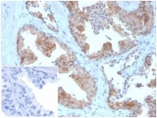 IHC staining of FFPE human prostate tissue with MIF antibody (clone MIF/3490). Negative control inset: PBS instead of primary antibody to control for secondary binding. HIER: boil tissue sections in pH 9 10mM Tris with 1mM EDTA for 20 min and allow to cool before testing.