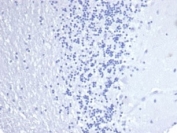 Negative control: IHC staining of FFPE human brain tissue using Keratin 14 antibody (clone KRT14/4584R) at 2ug/ml in PBS for 30min RT. HIER: boil tissue sections in pH 9 10mM Tris with 1mM EDTA for 20 min and allow to cool before testing.