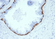 IHC staining of FFPE human prostate tissue with Cytokeratin 14 antibody (clone KRT14/4584R). HIER: boil tissue sections in pH 9 10mM Tris with 1mM EDTA for 20 min and allow to cool before testing.