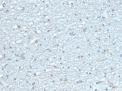IHC staining of FFPE human brain tissue with LEPR antibody (clone LEPR/4304). HIER: boil tissue sections in pH 9 10mM Tris with 1mM EDTA for 20 min and allow to cool before testing.