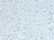IHC staining of FFPE human brain tissue with LEPR antibody (clone LEPR/4304). HIER: boil tissue sections in pH 9 10mM Tris with 1mM EDTA for 20 min and allow to cool before testing.