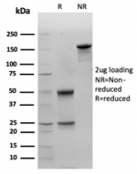 SDS-PAGE analysis of purified, BSA-free LGALS3 antibody (clone LGALS3/4792) as confirmation of integrity and purity.