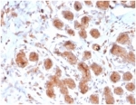 IHC staining of FFPE human breast tissue with LTF antibody (clone LTF/4073). HIER: boil tissue sections in pH 9 10mM Tris with 1mM EDTA for 20 min and allow to cool before testing.