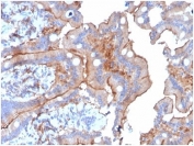 IHC staining of FFPE human colon tissue with LY75/DEC-205 antibody (clone CD205/3720). HIER: boil tissue sections in pH 9 10mM Tris with 1mM EDTA for 20 min and allow to cool before testing.