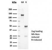 SDS-PAGE analysis of purified, BSA-free recombinant MUC5AC antibody (clone MUC5AC/7068R) as confirmation of integrity and purity.
