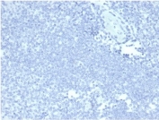 Negative control: IHC staining of FFPE human tonsil tissue with recombinant MUC5AC antibody (MUC5AC/7068R) at 2ug/ml in PBS for 30min RT. HIER: boil tissue sections in pH 9 10mM Tris with 1mM EDTA for 20 min and allow to cool before testing.