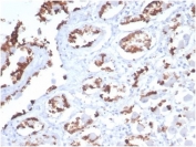 IHC staining of FFPE human stomach tissue with recombinant MUC5AC antibody (clone MUC5AC/7068R) at 2ug/ml. HIER: boil tissue sections in pH 9 10mM Tris with 1mM EDTA for 20 min and allow to cool before testing.
